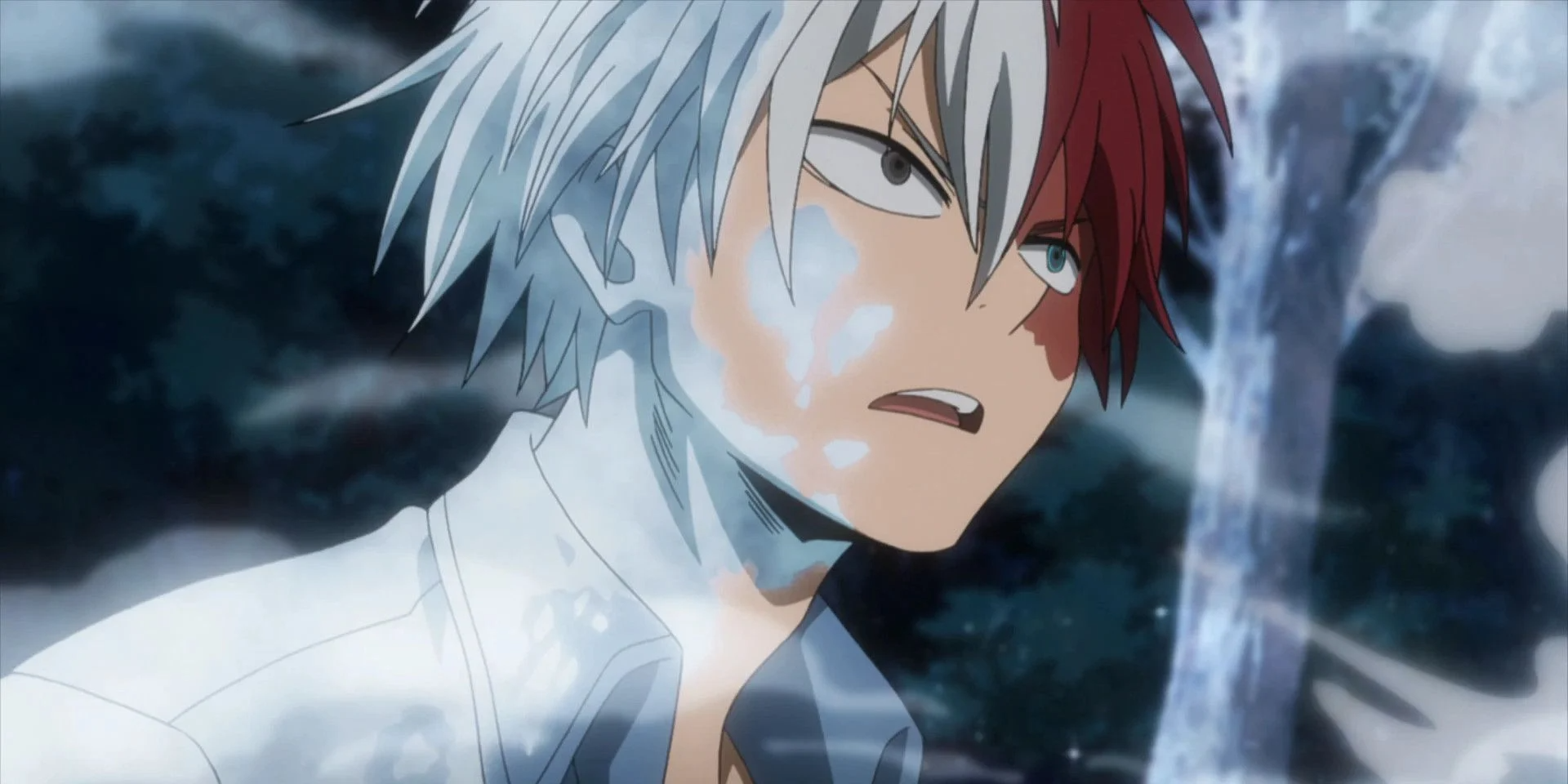 Why does Shoto Todoroki have ice on his face?